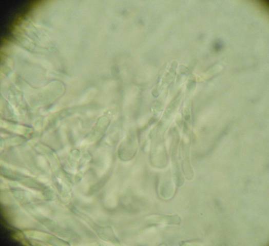 Da determinare (Antrodia albida)